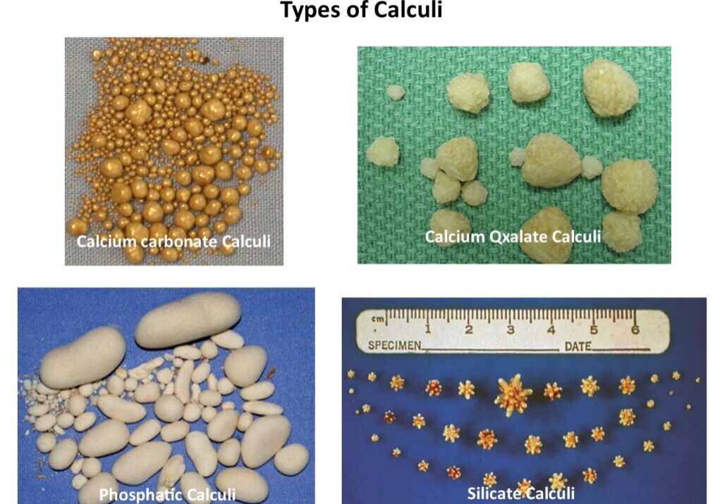 Types of calculi
