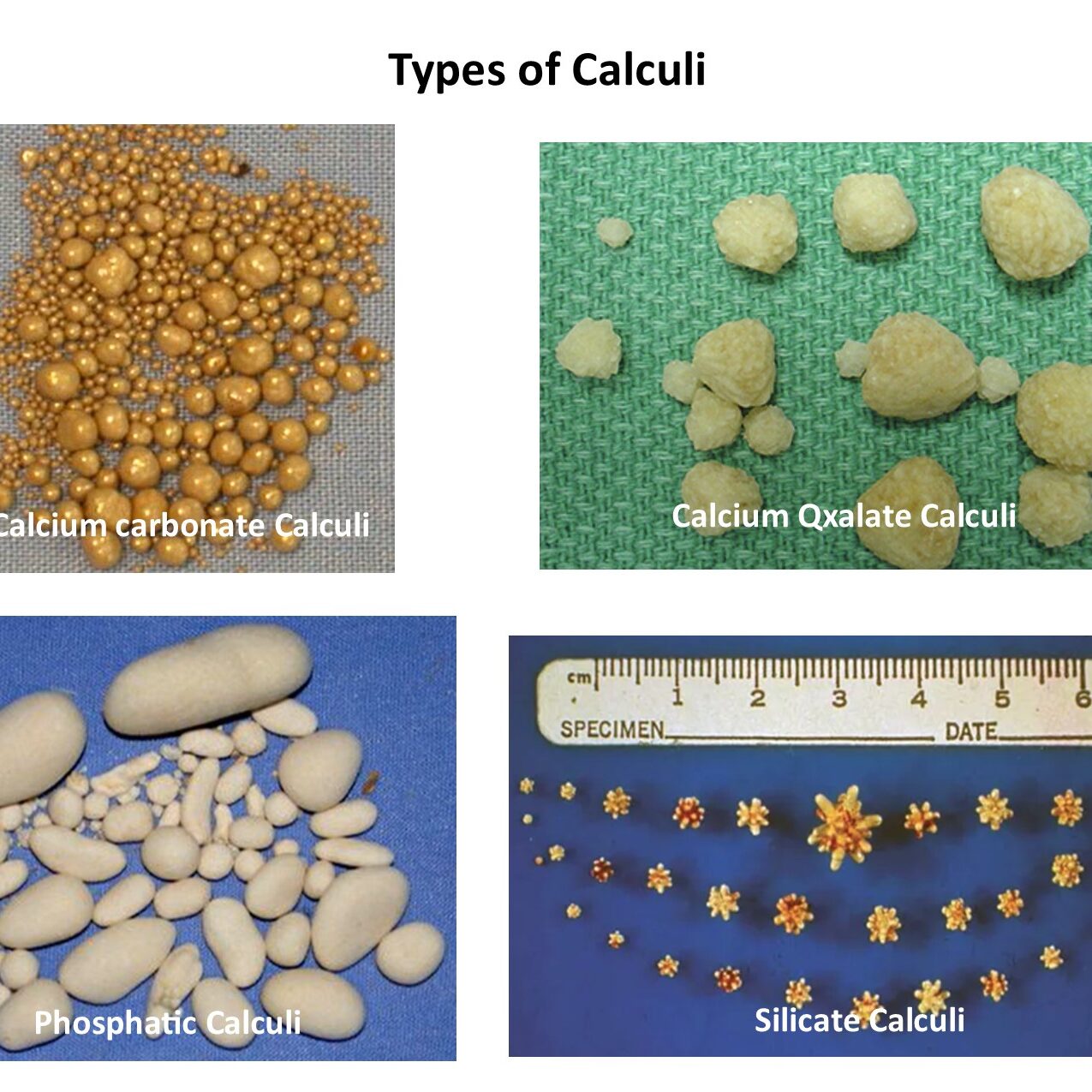 Types of calculi